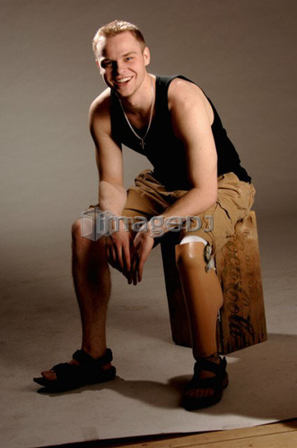 Portrait of young man (21 years of age) showing his prosthesis, having lost lower leg to cancer; Canada, Saskatchewan, Regina