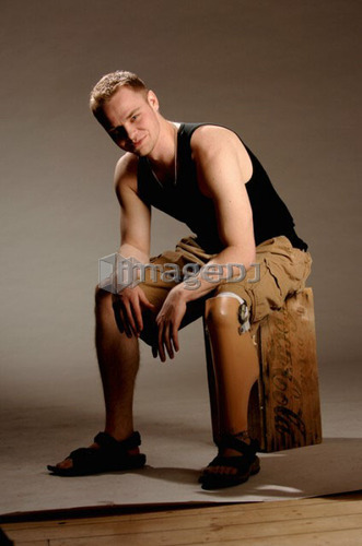 Portrait of young man (21 years of age) showing his prosthesis, having lost lower leg to cancer; Canada, Saskatchewan, Regina