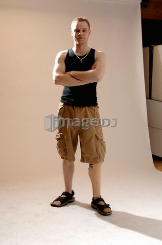 Portrait of young man (21 years of age) showing his prosthesis, having lost lower leg to cancer; Canada, Saskatchewan, Regina